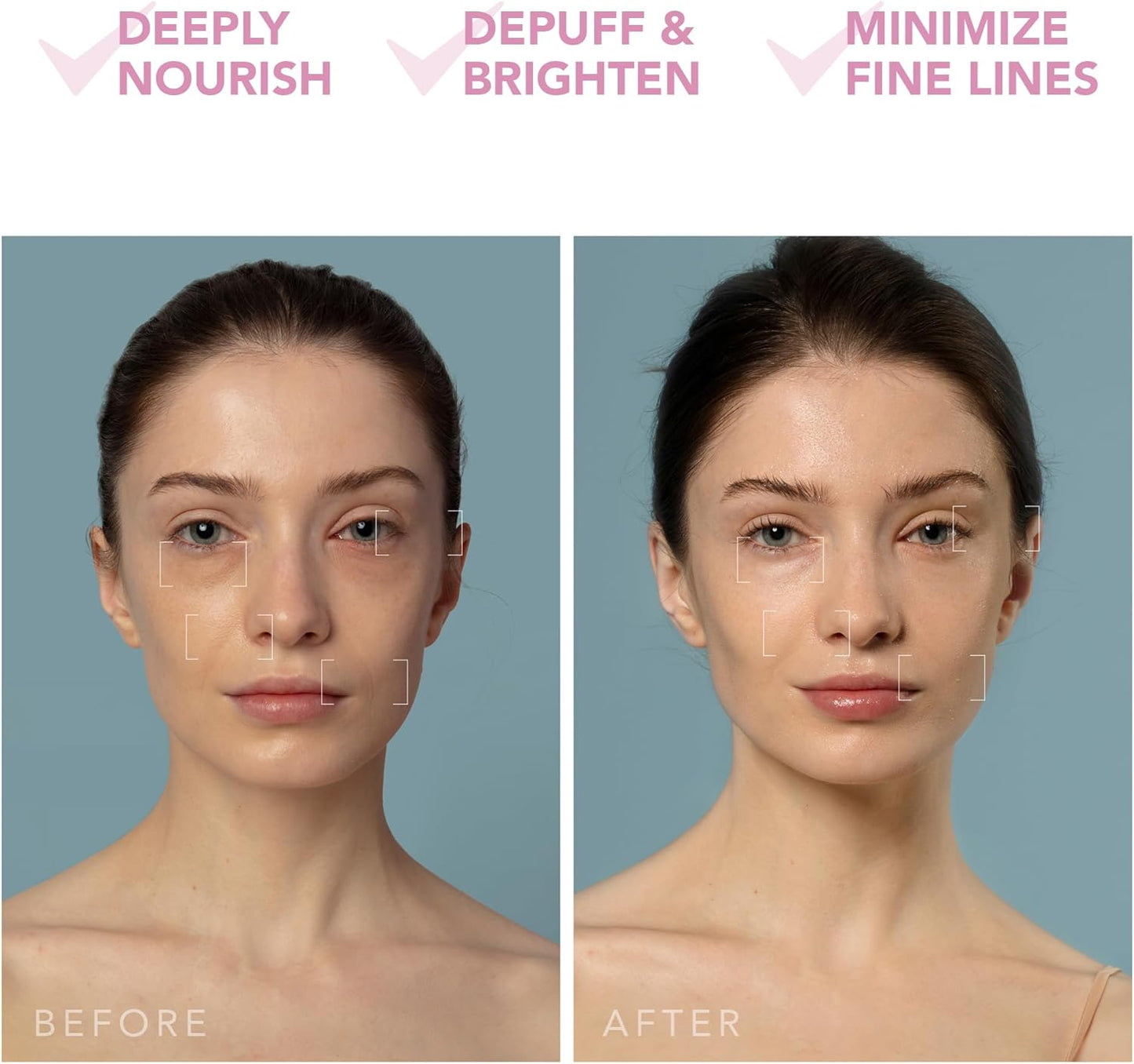 2026 FOREO UFO 3 – Masque Visage Intelligent 5-en-1 avec LED, Thermothérapie, Cryothérapie et Massage T-Sonic – Édition Limitée Anti-Âge