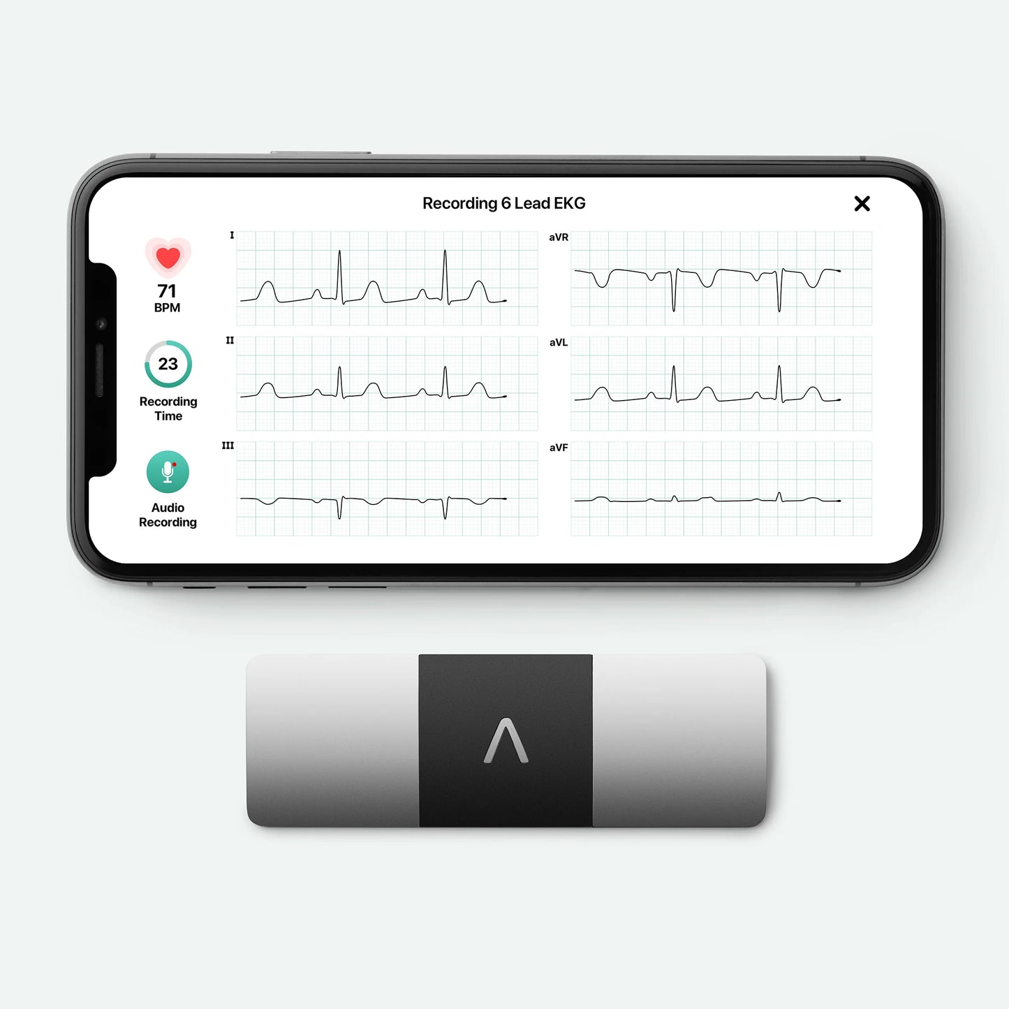 2026 KardiaMobile 6L – Appareil ECG personnel à six dérivations