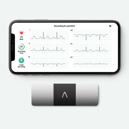 2026 KardiaMobile 6L – Appareil ECG personnel à six dérivations
